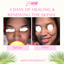 Load image into Gallery viewer, TURMERIC EXFOLIATOR + MASK