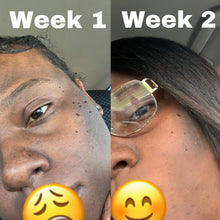 Load image into Gallery viewer, TURMERIC EXFOLIATOR + MASK
